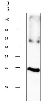 TIP2 | Tonoplast intrinsic protein 2;1, 2;2, 2;3 in the group Antibodies Plant/Algal / Membrane Transport System / Vacuolar membrane at Agrisera AB (Antibodies for research) (AS12 2619)